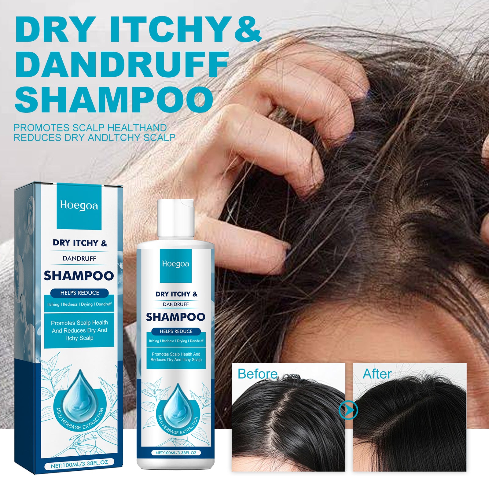 Hoegoa Dry itchy & Dandruff Shampoo Type: Solid shampoo - La Charlottes