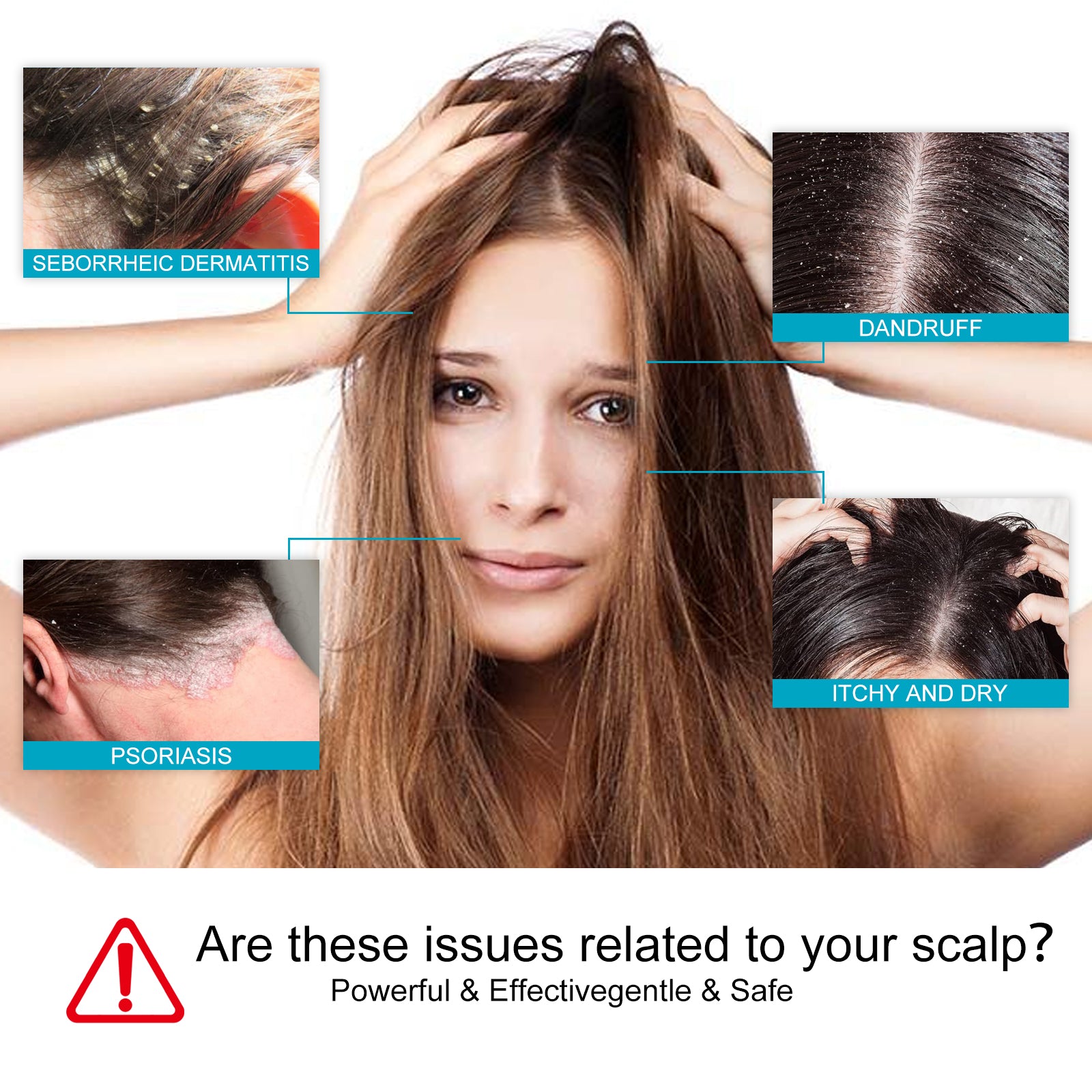 Hoegoa Dry itchy & Dandruff Shampoo Type: Solid shampoo - La Charlottes