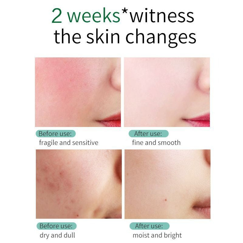 SKIN EVER Centella Repair Face Cream – Moisturizing & Repairing Facial - La Charlottes