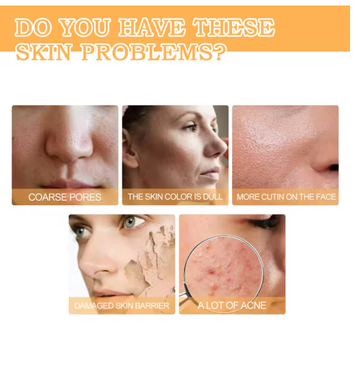 Eelhoe - Glycolic Acid 7% Toning Solution - La Charlottes